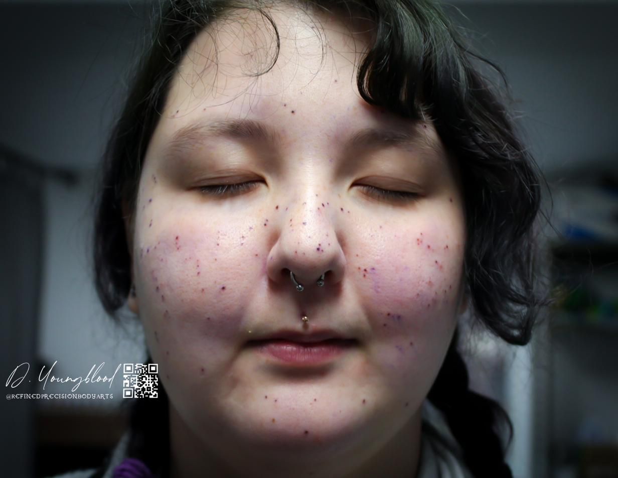 Colored freckles — view 2